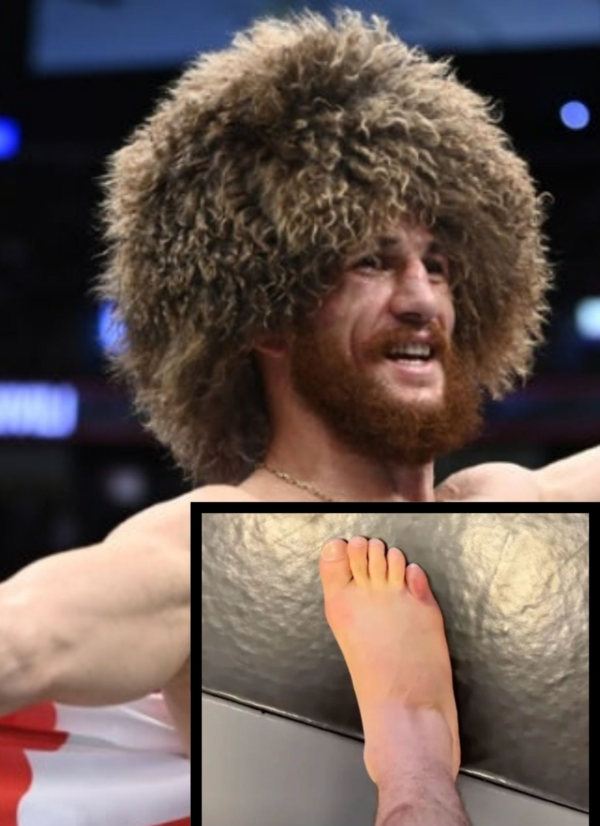 드발리시빌리, UFC 밴텀급 챔피언 발가락 부상으로도 "타이틀전 준비 완료" 썸네일 이미지
