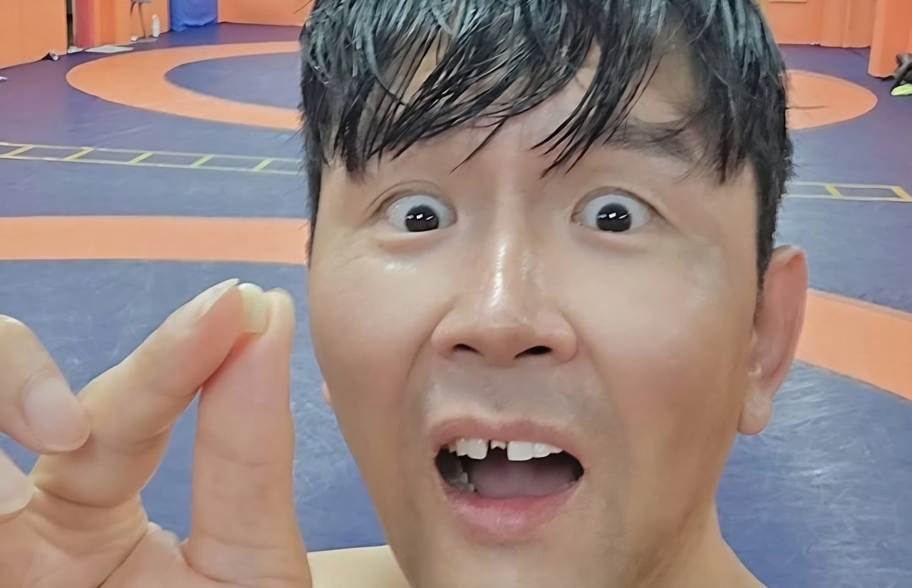 밴쯔와의 대결 코앞! 윤형빈의 앞니 사라진 비밀, 운명의 맞대결은 어떻게 전개될까? 썸네일 이미지